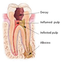 Microscope Root Canal (Endodontics)