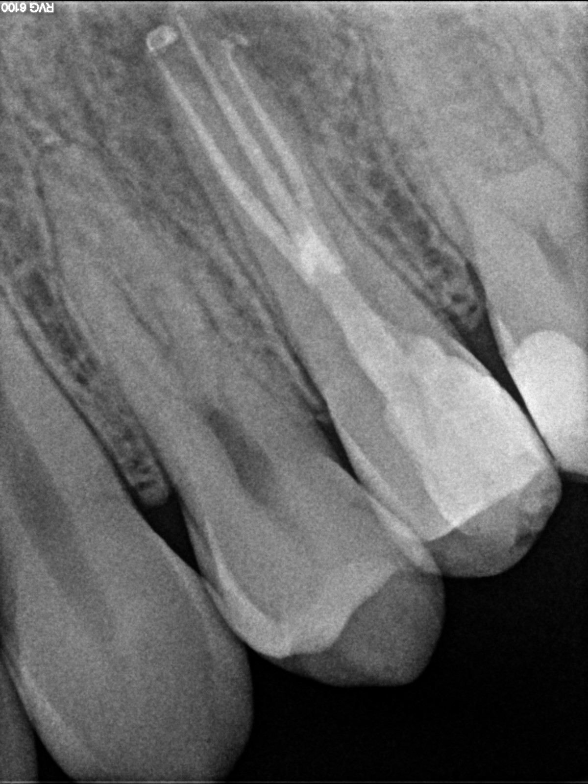 Precision Implant Osseointegration